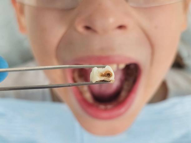  Barrackville, WV Emergency Dentist Pros